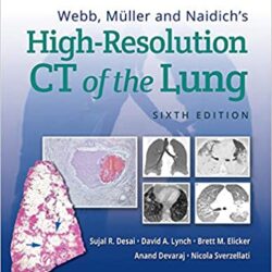 Webb, Müller and Naidich’s High-Resolution CT of the Lung Sixth Edition