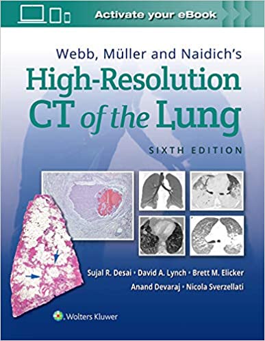 Webb Muller and Naidichs High Resolution CT of the Lung Sixth Edition