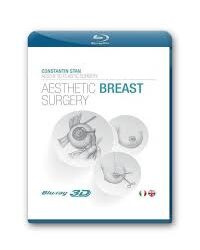constantin stan aesthetic breast surgery (Videos operative)