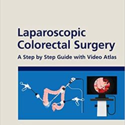 Chirurgie colorectale laparoscopique : Un guide étape par étape avec vidéo Atlas 1ère édition