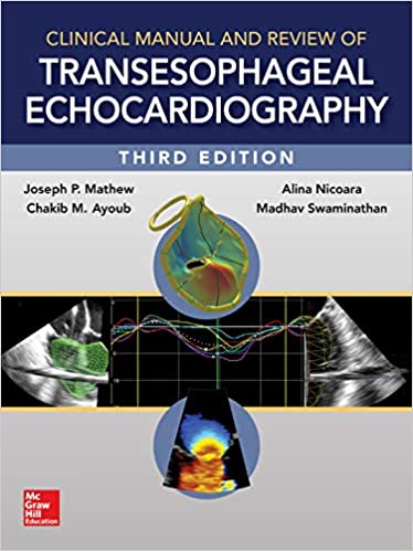 linical Manual and Review of Transesophageal Echocardiography
