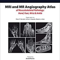 Angiografía por RM y RM Atlas de patología musculoesquelética: mano, pie, muñeca y tobillo