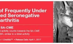 2017 imaging of frequently under recognized seronegative spondyloarthritis