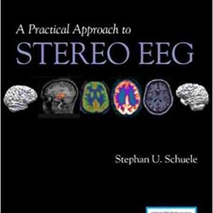 A Practical Approach to Stereo EEG