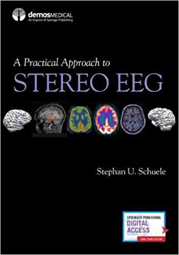 PDF EPUBA Practical Approach to Stereo EEG