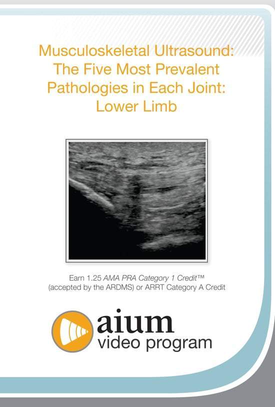 Ultrasonografia AIUM MSK: pięć najczęściej występujących patologii w każdym stawie: kończyna dolna