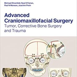 Advanced Craniomaxillofacial Surgery : Tumor, Corrective Bone Surgery, and Trauma1st Edition First ed 1e
