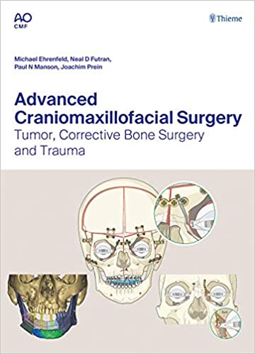 Advanced Craniomaxillofacial Surgery Tumor Corrective Bone Surgery and Trauma 1st Edition