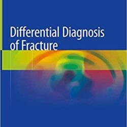 Differential Diagnosis of Fracture 1st ed. 2021 Edition