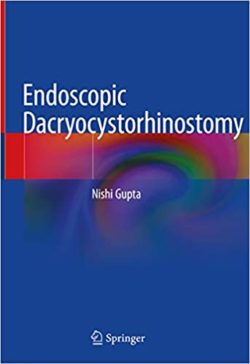 Endoscopic Dacryocystorhinostomy 1st ed. 2021 Edition