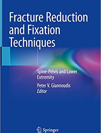 Fracture Reduction and Fixation Techniques: Spine-Pelvis and Lower Extremity FIRST ED/1e 1st ed. 2020 Edition