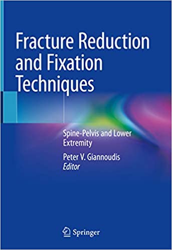 Fracture Reduction and Fixation Techniques: Spine-Pelvis and Lower Extremity FIRST ED/1e 1st ed. 2020 Edition