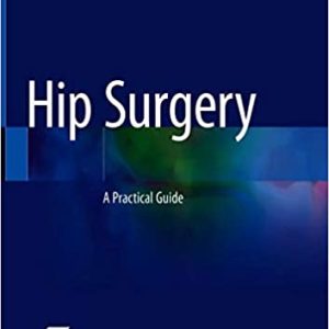 Hip Surgery: A Practical Guide 1st ed. 2021 Edition