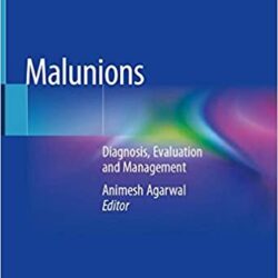 Malunions: Diagnosis, Evaluation and Management 1st ed. 2021 Edition