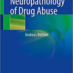 Neuropathologie de l'abus de drogues 1ère éd. Édition 2021