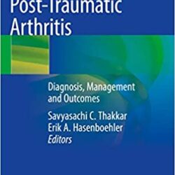 Post-Traumatic Arthritis: Diagnosis, Management and Outcomes 1st ed. 2021 Edition