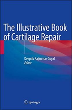 The Illustrative Book of Cartilage Repair 1st ed. 2021 Edition