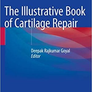 The Illustrative Book of Cartilage Repair 1st ed. 2021 Edition