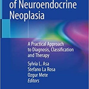 The Spectrum of Neuroendocrine Neoplasia: A Practical Approach to Diagnosis, Classification and Therapy 1st ed. 2021 Edition