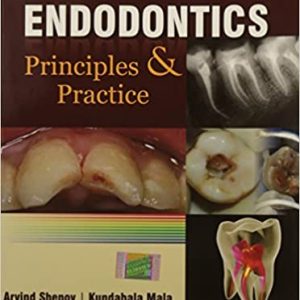 Endodontics Principles and Practice