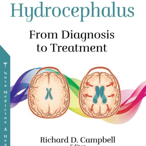 Hydrocephalus: From Diagnosis to Treatment