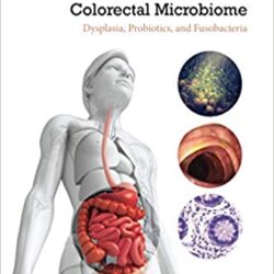 Colorectal Neoplasia and the Colorectal Microbiome: Dysplasia, Probiotics, and Fusobacteria 1st Edition
