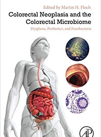 Colorectal Neoplasia and the Colorectal Microbiome: Dysplasia, Probiotics, and Fusobacteria 1st Edition