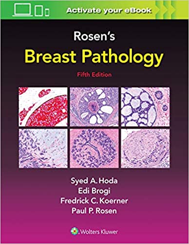 Rosen’s Breast Pathology, 5th Edition by Syed A. Hoda,Paul Peter Rosen,Edi Brogi and …..