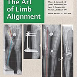 The Art of Limb Alignment 9th Edition