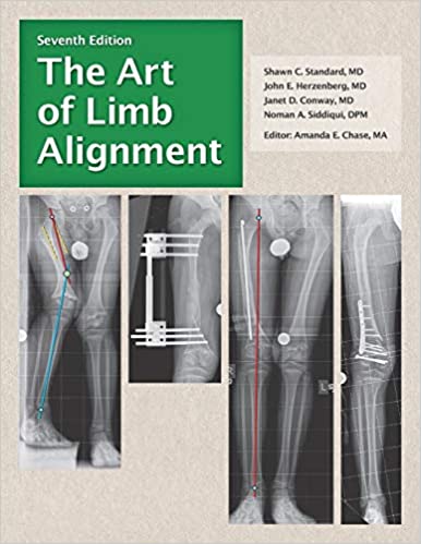 The Art of Limb Alignment 9th Edition