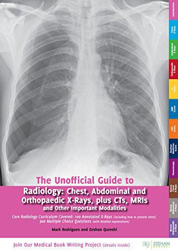 Unofficial Guide to Radiology: Chest, Abdominal and Orthopaedic X Rays, Plus CTs, MRIs and Other Important Modalities: Core Radiology Curriculum (Unoffical Guides) 1st Edition
