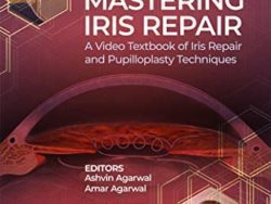 Mastering Iris Repair: A Video Textbook of Iris Repair and Pupilloplasty Techniques 1st Edition