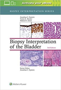 Biopsy Interpretation of the Bladder, (Biopsy Interpretation Series Bladder Third Ed/3e) 3rd Edition by Jonathan Epstein,Victor Reuter
