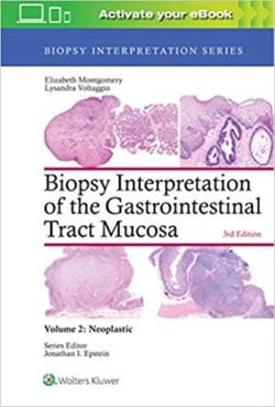 Biopsy Interpretation of the Gastrointestinal Tract Mucosa: Volume-2 Neoplastic Third Edition (Biopsy Interpretation Series  Gastrointestinal 3rd/3e ).