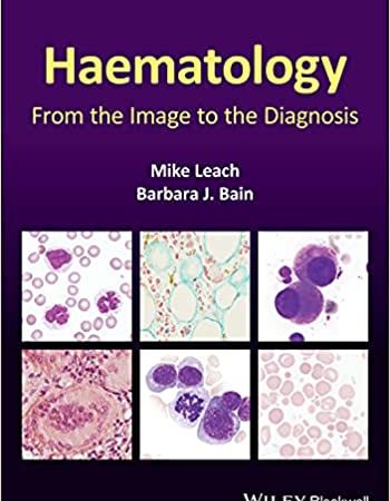 Haematology: From the Image to the Diagnosis 1st Edition