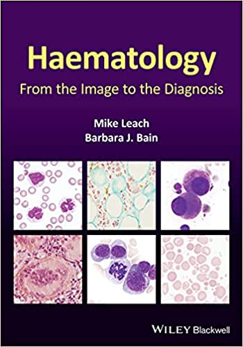 Haematology From The Image To The Diagnosis
