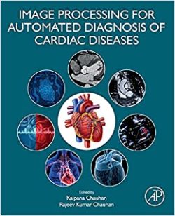 Image Processing for Automated Diagnosis of Cardiac Diseases