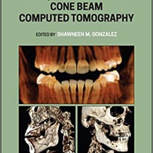 Interpretation Basics of Cone Beam Computed Tomography 2nd Edition