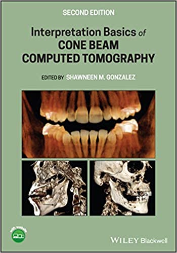 Interpretation Basics of Cone Beam Computed Tomography 2nd Edition