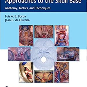 Microsurgical and Endoscopic Approaches to the Skull Base Anatomy, Tactics, and Techniques 1st Edition