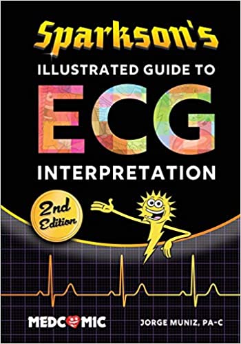 Sparkson’s Illustrated Guide to ECG Interpretation, 2nd Edition (Sparkson Illustrated Guide)