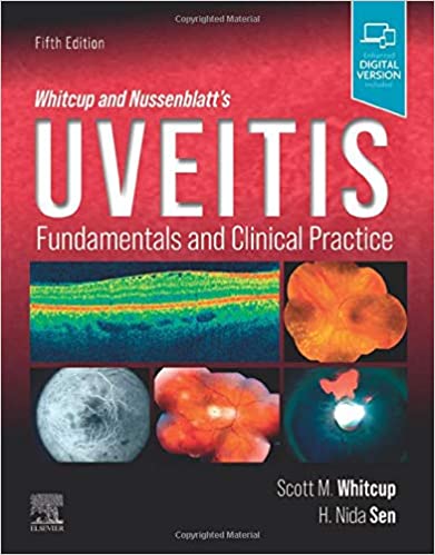 Whitcup and Nussenblatts Uveitis Fundamentals and Clinical Practice 5th Edition