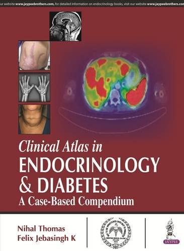 Clinical Atlas in Endocrinology & and Diabetes: A Case-Based Compendium 1st Edition