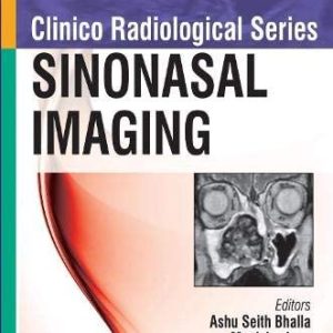 Clinico Radiological Series: Sinonasal Imaging