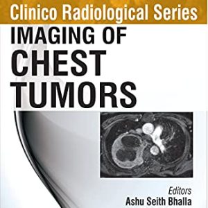 Clinico Radiological Series: Imaging Of Chest Tumors