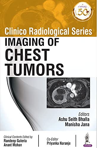Clinico Radiological Series: Imaging Of Chest Tumors