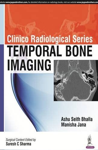 Clinico Radiological Series: Temporal Bone Imaging 2nd Edition