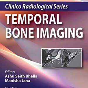 Clinico Radiological Series: Temporal Bone Imaging 2nd Edition