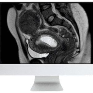 ARRS Abdominal MRI: Practical Applications and Advanced Imaging Techniques 2021 (CME VIDEOS)