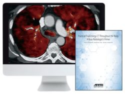 ARRS Practical Dual-Energy CT Throughout the Body 2021 (CME VIDEOS)